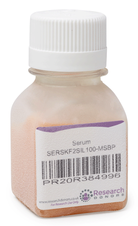 Research Donors Serum (Stock)